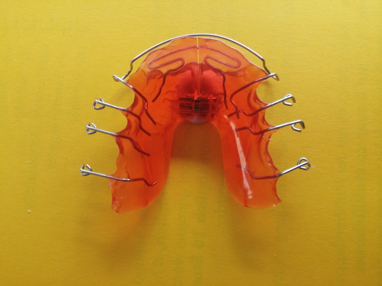 牙齒深覆合矯正價(jià)格詳解，影響因素與費(fèi)用分析指南